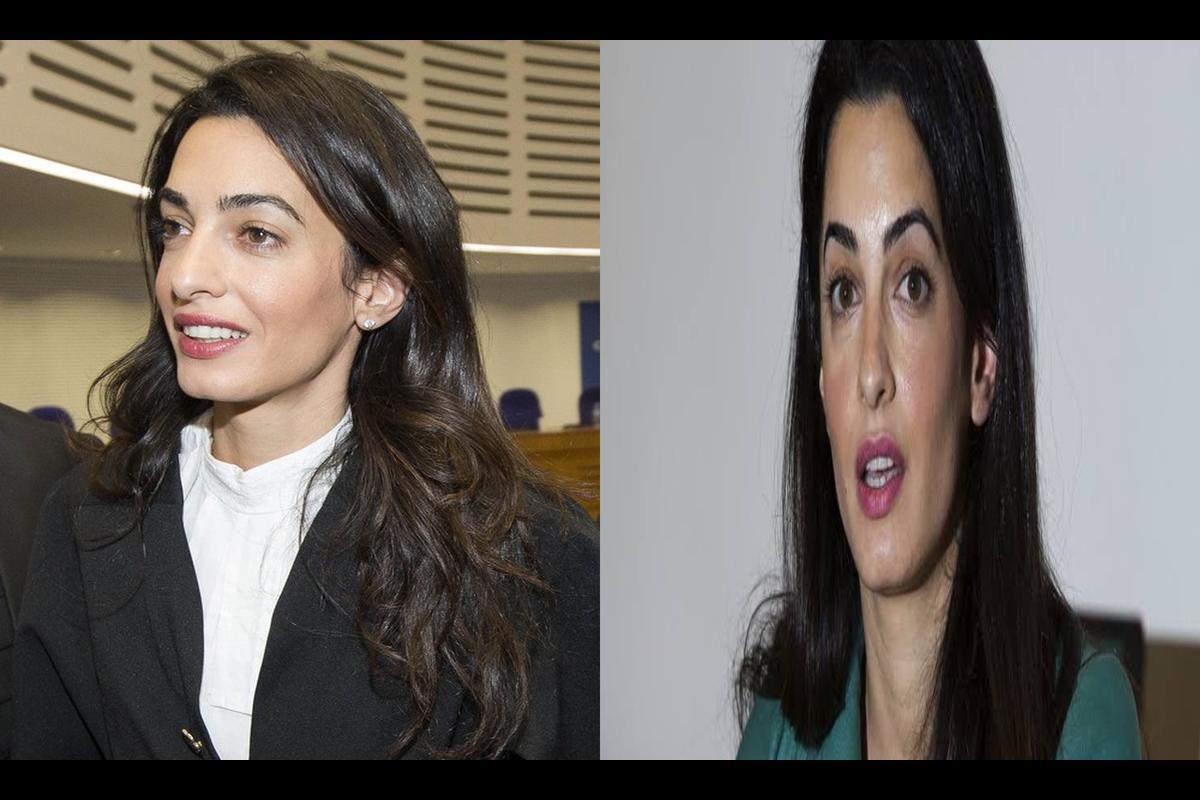 Unveiling the Truth: Did Amal Clooney Undergo Plastic Surgery?