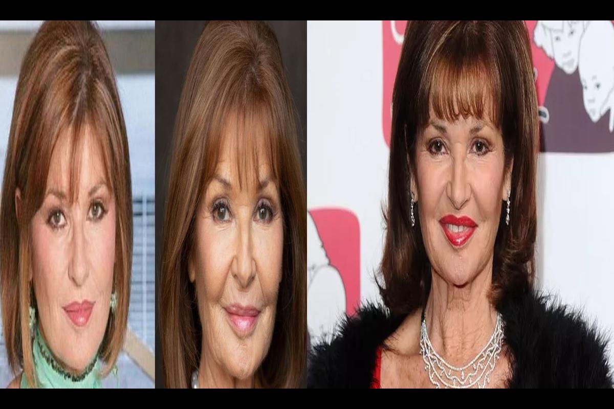 Discovering the Truth About Stephanie Beacham's Plastic Surgery Rumors
