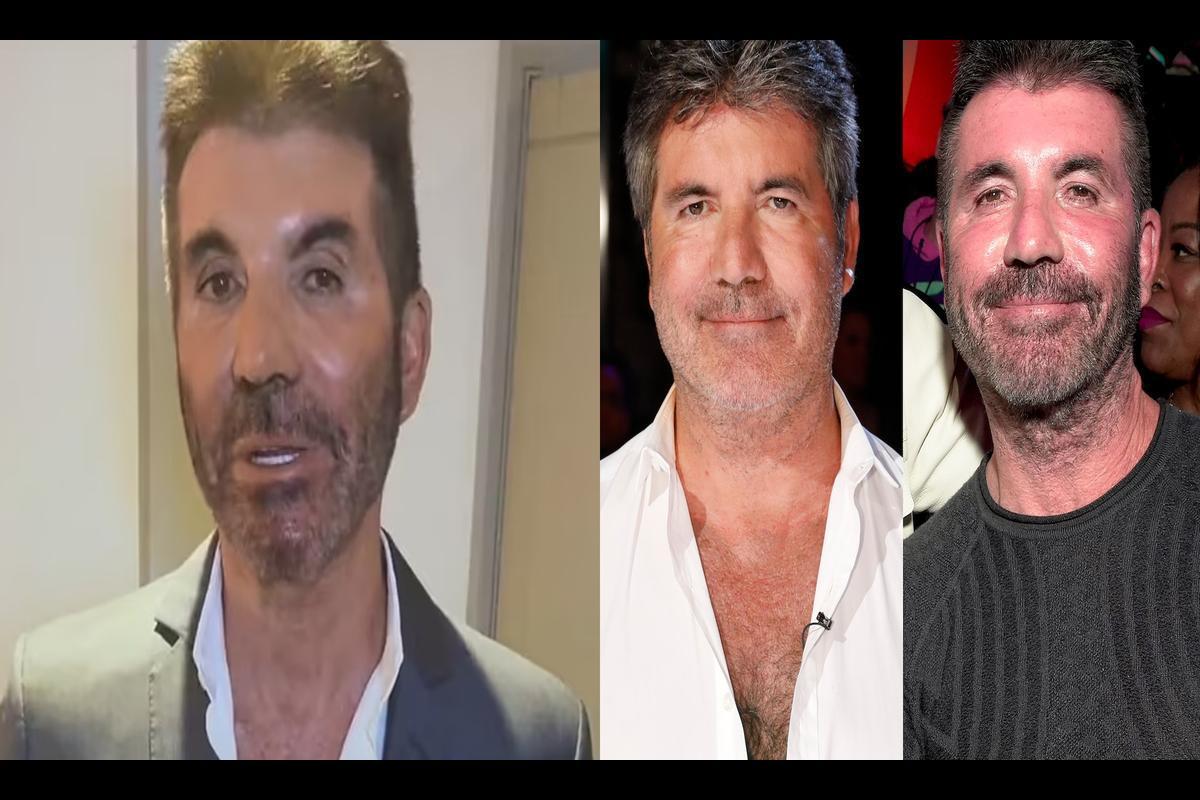 Simon Cowell: Unveiling the Truth Behind His Cosmetic Enhancements